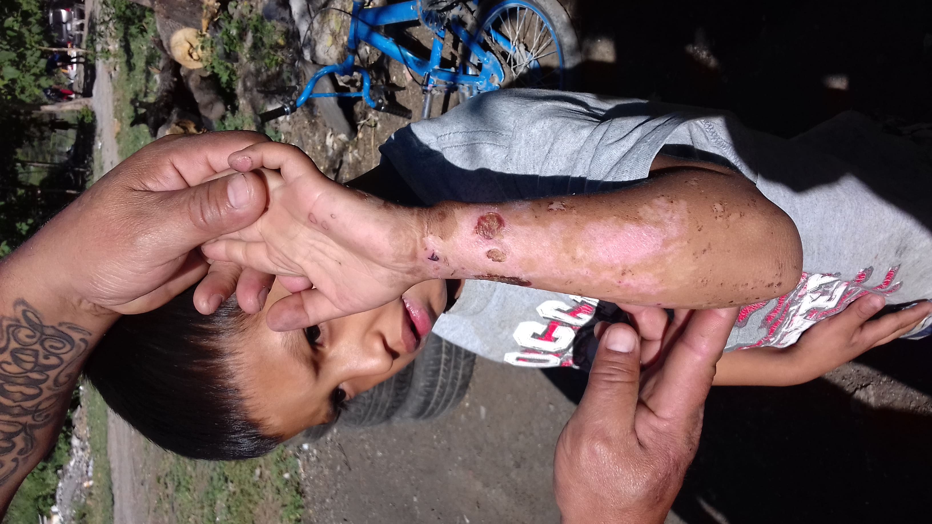 Health diagnosis in settlement