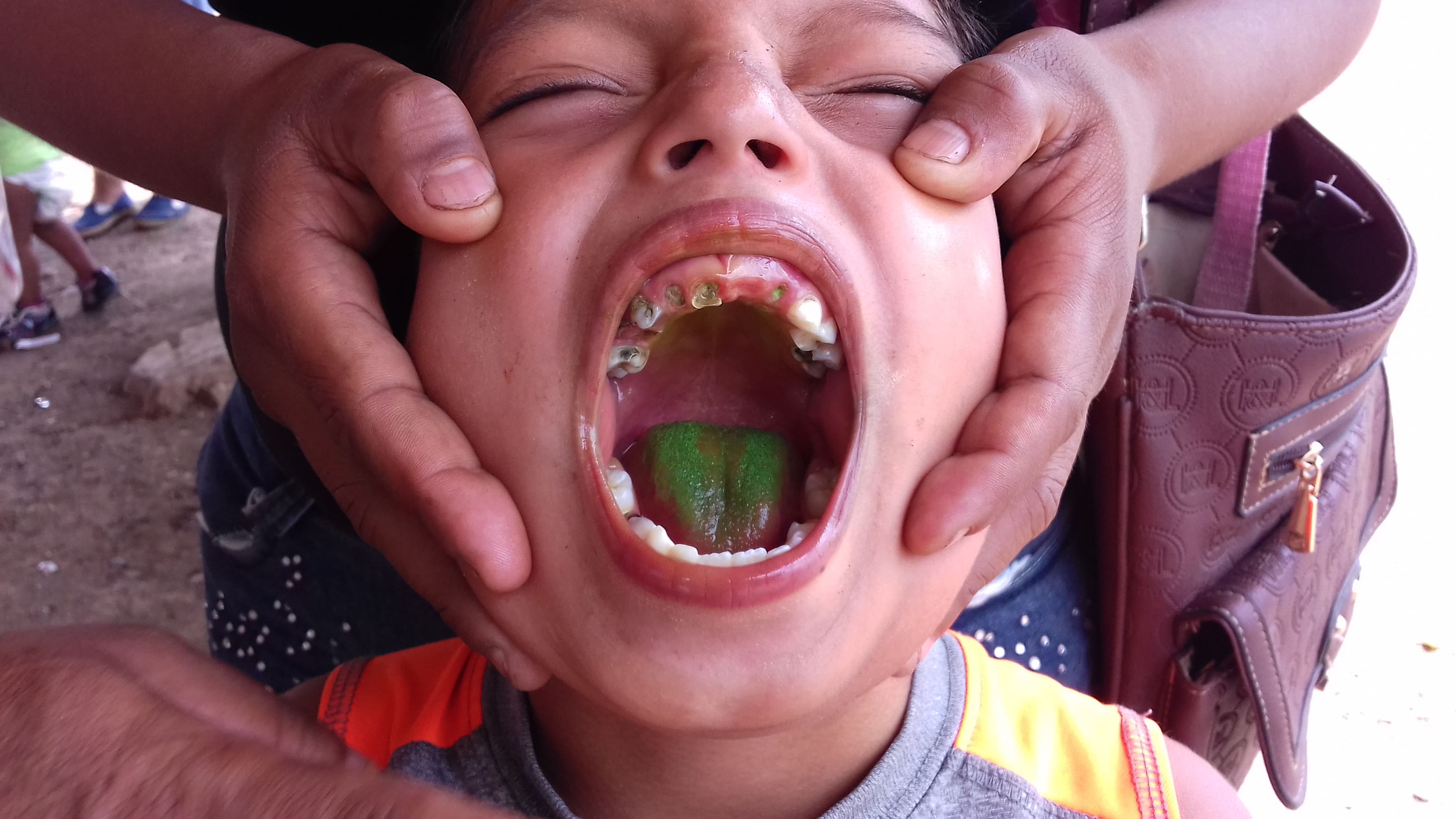 Untreated dental, wound care or health issues we diagnose